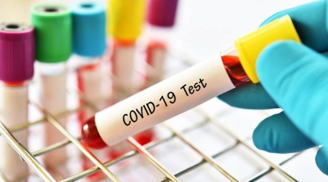 Covid Test Paraları İade Edilecek