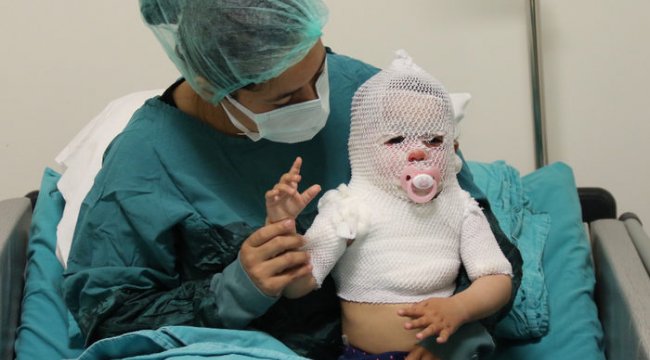 Türkiye'nin konuştuğu Beril bebek iyileşmeye başladı